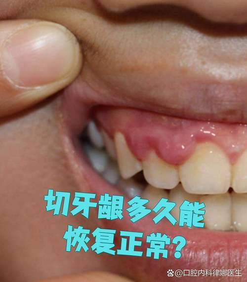 正畸牙齿矫正为何会引发牙龈增生？背后原因、影响及应对方法有哪些？-图2