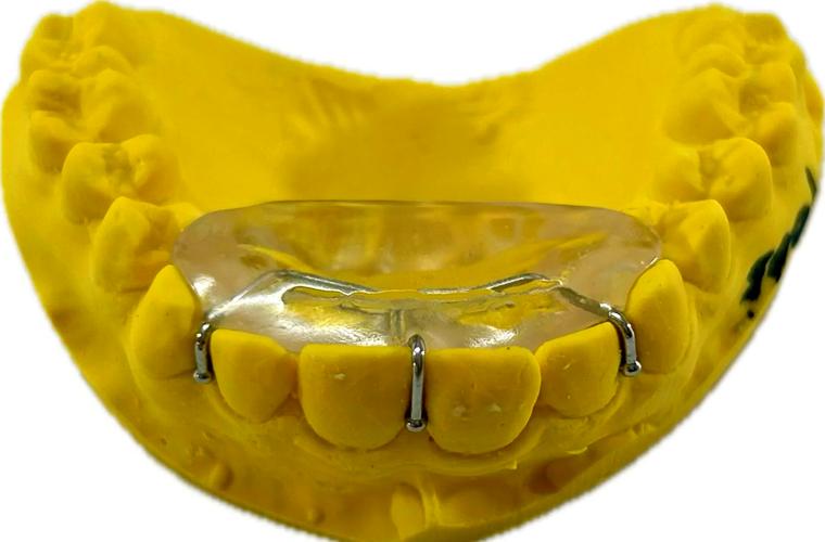 正畸平面导板制作需要准备哪些材料?具体操作步骤和注意事项有哪些?-图1 正畸平面导板制作需要准备哪些材料?具体操作步骤和注意事项有哪些?-图1