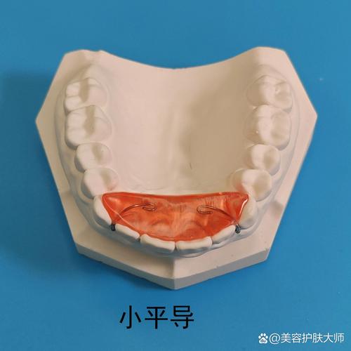 正畸平面导板制作需要准备哪些材料?具体操作步骤和注意事项有哪些?-图2 正畸平面导板制作需要准备哪些材料?具体操作步骤和注意事项有哪些?-图2