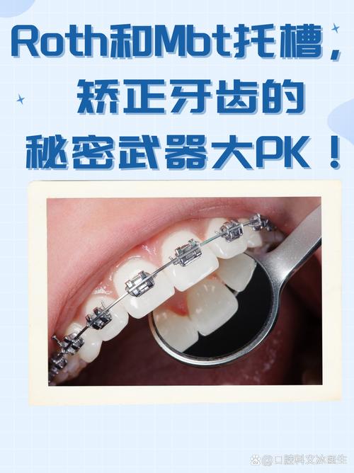 正畸矫正时2号和4号牙齿通常需要粘几个托槽?数量是否因矫正阶段或牙齿情况不同而变化?-图1 正畸矫正时2号和4号牙齿通常需要粘几个托槽?数量是否因矫正阶段或牙齿情况不同而变化?-图1