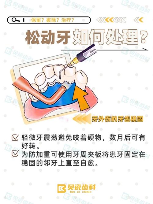 正畸期间牙齿松动是正常现象吗？原因是什么，会影响牙齿健康和矫正效果吗？-图2