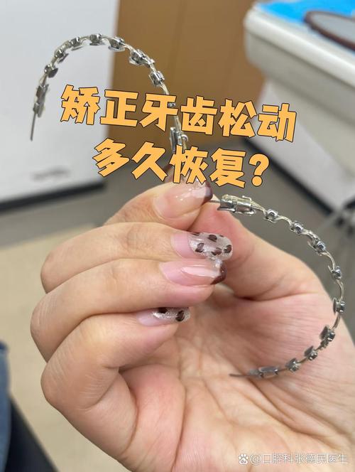 正畸期间牙齿松动是正常现象吗？原因是什么，会影响牙齿健康和矫正效果吗？-图1