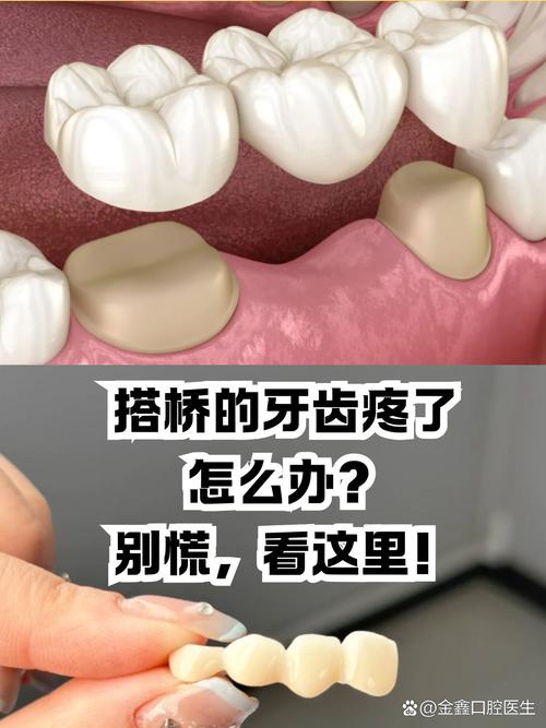 牙齿被磨过后出现敏感、缺损，有哪些补救方法能修复并预防进一步损伤？-图3