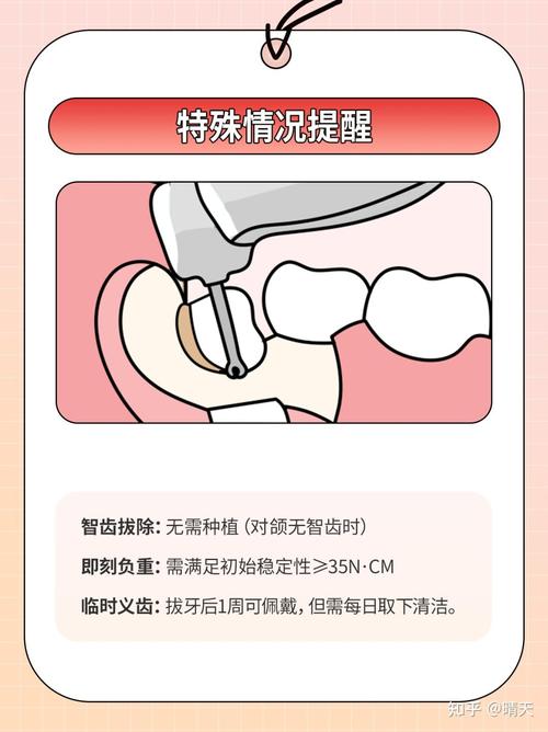 拔牙后多久可以种牙-图3 拔牙后多久可以种牙-图3