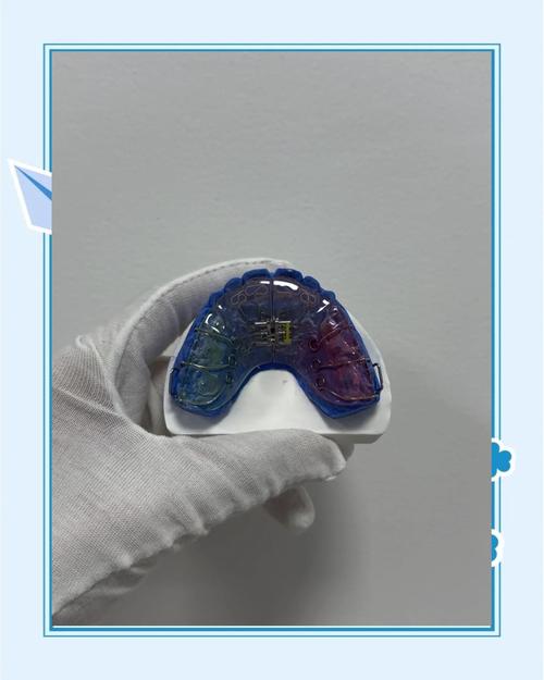 螺旋扩弓器使用方法-图2 螺旋扩弓器使用方法-图2