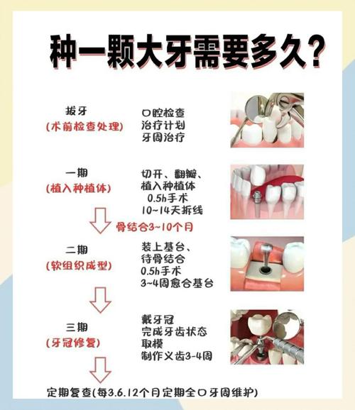 一小时种牙真的靠谱吗?揭秘即刻种植技术的安全性、适用人群与长期效果隐患-图1 一小时种牙真的靠谱吗?揭秘即刻种植技术的安全性、适用人群与长期效果隐患-图1