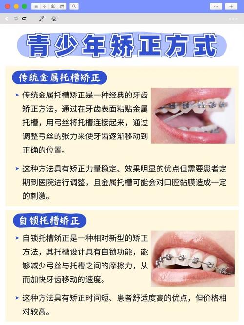 正畸矫正的定义具体指什么?它包含哪些核心内容与治疗目标?-图2 正畸矫正的定义具体指什么?它包含哪些核心内容与治疗目标?-图2