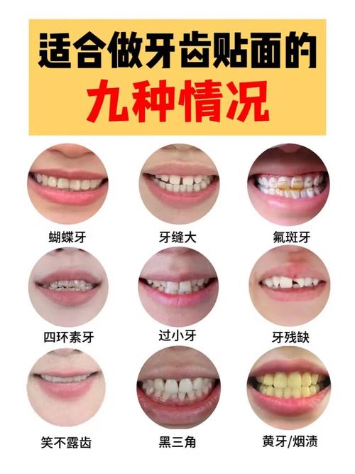 种牙后服用四环素会影响种植体骨结合效果或引发不良反应吗？-图1