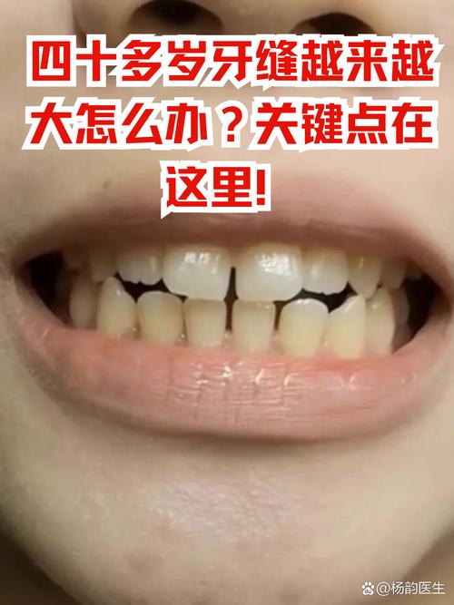 正畸半年门牙缝变得特别大，是什么原因导致的？会影响最终矫正效果吗？-图3