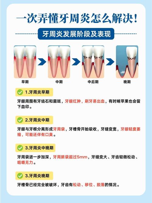 根尖周炎的治疗方法有哪些?急性与慢性阶段的治疗方案有何差异?如何选择最适合自身的治疗方式?-图2 根尖周炎的治疗方法有哪些?急性与慢性阶段的治疗方案有何差异?如何选择最适合自身的治疗方式?-图2