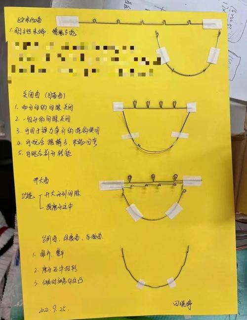 正畸结扎丝结扎的具体步骤有哪些？不同托槽类型的结扎技巧有何差异？操作中需注意哪些关键细节？-图1