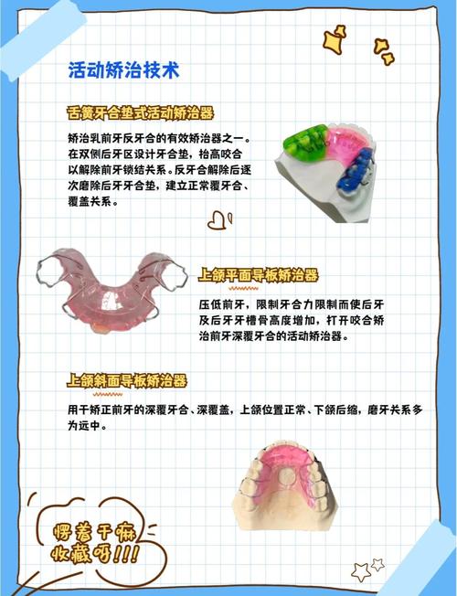 牙齿矫正有什么方法-图3