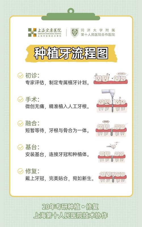 种一棵牙到底需要多长时间?不同缺牙情况、牙槽骨条件会影响种植周期吗?-图2 种一棵牙到底需要多长时间?不同缺牙情况、牙槽骨条件会影响种植周期吗?-图2