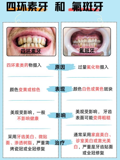 四环素牙颜色深、传统美白效果差,究竟哪些方法能真正安全有效改善?-图1 四环素牙颜色深、传统美白效果差,究竟哪些方法能真正安全有效改善?-图1