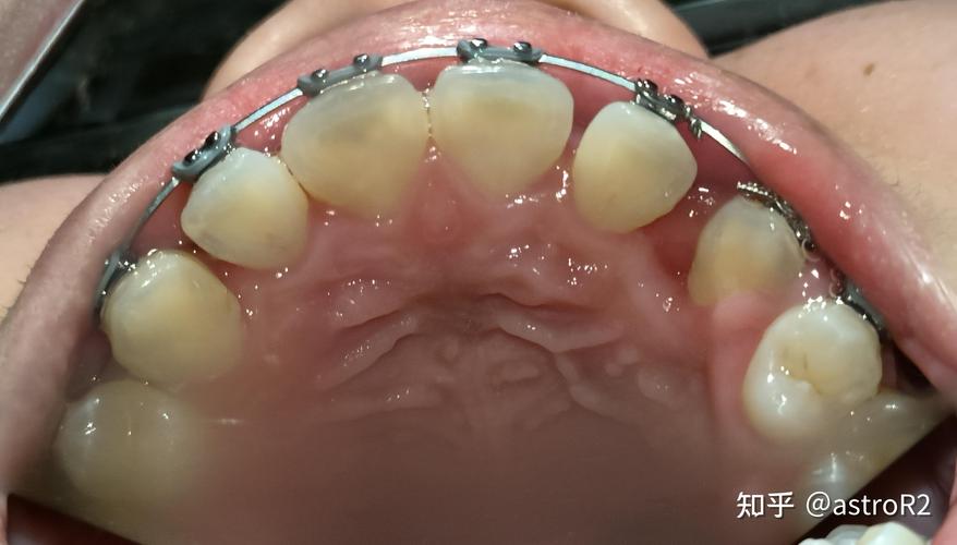 北大国际医院的正畸技术怎么样？医生团队专业水平如何？价格和服务体验靠谱吗？-图3