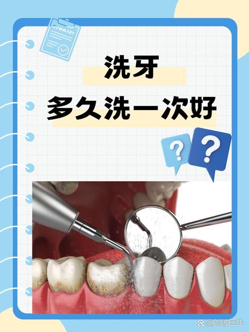 哪一种洗牙方法好-图2 哪一种洗牙方法好-图2