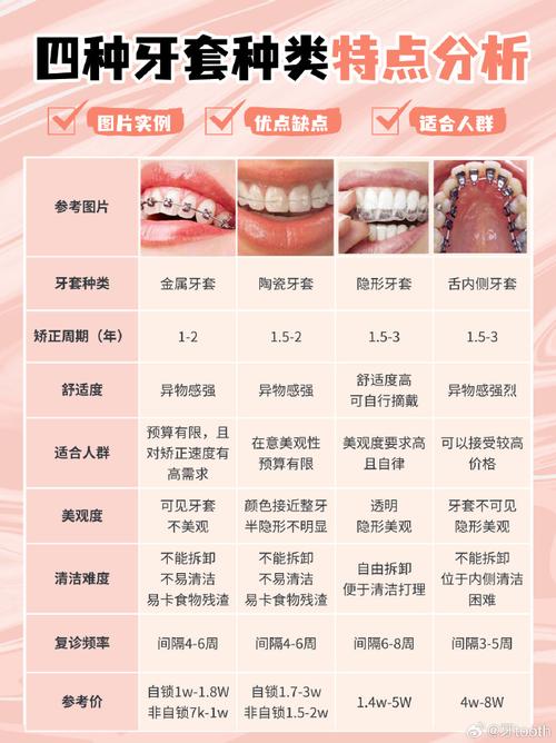 牙套有哪三种常见材料?不同材料各自的特点、适用情况及优缺点该如何区分选择呢?-图1 牙套有哪三种常见材料?不同材料各自的特点、适用情况及优缺点该如何区分选择呢?-图1