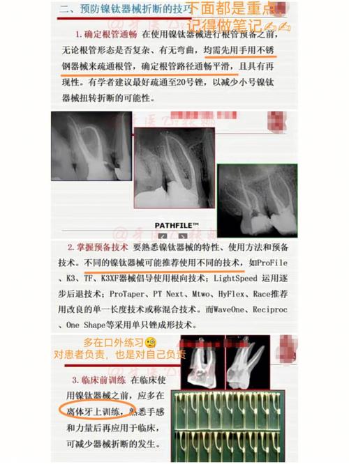 s3镍钛的正确使用方法是什么？操作时有哪些关键步骤和注意事项需要特别注意？-图2