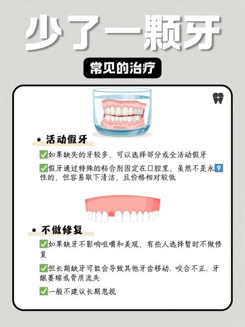 一颗牙缺损后,修复方法有哪些?哪种更适合不同情况?修复后能用多久?-图2 一颗牙缺损后,修复方法有哪些?哪种更适合不同情况?修复后能用多久?-图2