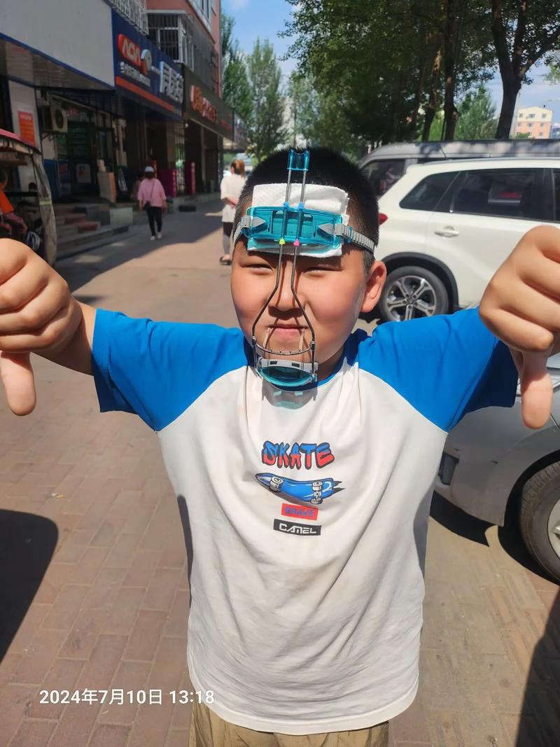 单侧反颌矫正方法有哪些？不同矫正技术的适应症、效果对比及术后护理要点是什么？-图2