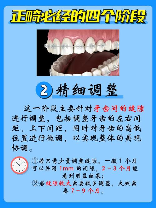 临面去釉矫正方法是什么原理?它主要针对哪些牙齿错颌问题?操作过程是否安全,会对牙齿造成永久损伤吗?-图3 临面去釉矫正方法是什么原理?它主要针对哪些牙齿错颌问题?操作过程是否安全,会对牙齿造成永久损伤吗?-图3