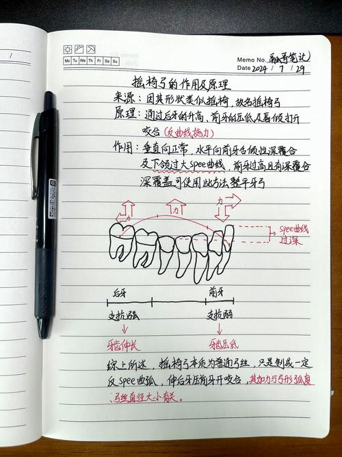 正畸治疗中摇椅弓的正确安放步骤是怎样的?有哪些关键细节需要注意?-图1 正畸治疗中摇椅弓的正确安放步骤是怎样的?有哪些关键细节需要注意?-图1