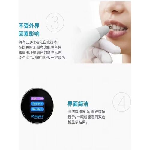 口腔s3的正确使用方法是什么?新手操作有哪些详细步骤和注意事项?-图2 口腔s3的正确使用方法是什么?新手操作有哪些详细步骤和注意事项?-图2