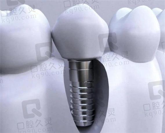 江苏省常州市种牙价格差异大？不同医院的技术、服务与效果如何对比选择？-图2