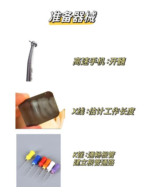 微根管的使用方法具体包含哪些操作步骤?新手初次使用时需注意哪些关键细节和常见问题?-图1 微根管的使用方法具体包含哪些操作步骤?新手初次使用时需注意哪些关键细节和常见问题?-图1