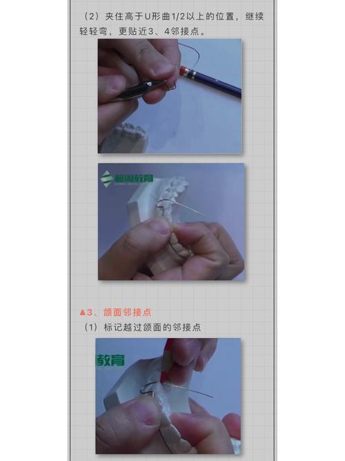 正畸唇弓弯制有哪些关键步骤？不同错颌类型如何调整弯制技巧？-图2