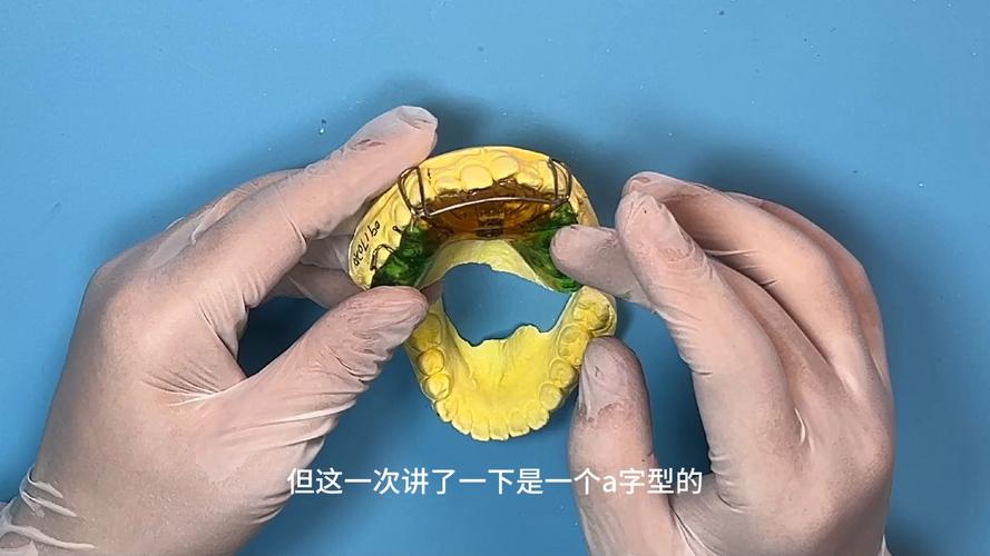 正畸唇弓弯制有哪些关键步骤?不同错颌类型如何调整弯制技巧?-图3 正畸唇弓弯制有哪些关键步骤?不同错颌类型如何调整弯制技巧?-图3