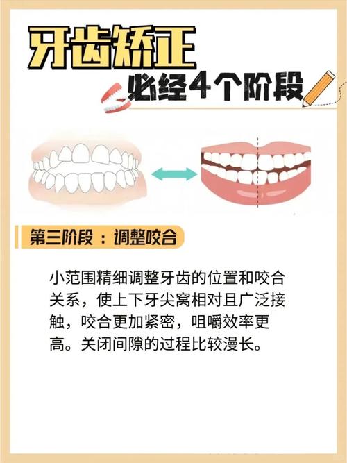 牙合架的使用方法具体包含哪些操作步骤？不同类型牙合架的操作是否存在差异？使用过程中需重点关注哪些细节以确保准确性？-图1