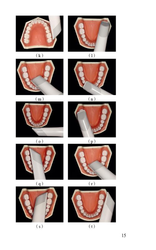 牙合架的使用方法具体包含哪些操作步骤？不同类型牙合架的操作是否存在差异？使用过程中需重点关注哪些细节以确保准确性？-图2