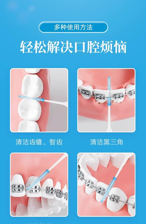 间齿刷的正确使用方法是什么？新手必看的清洁步骤、适用频率及注意事项全解析-图1