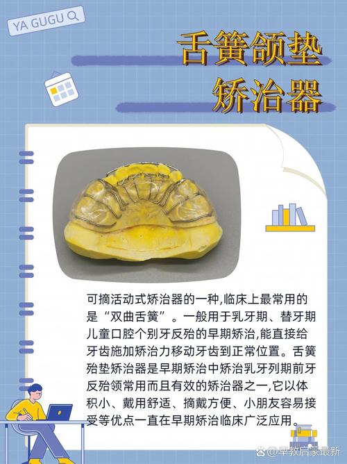 颌垫舌簧的正确使用方法是什么?具体操作步骤和注意事项有哪些?-图2 颌垫舌簧的正确使用方法是什么?具体操作步骤和注意事项有哪些?-图2