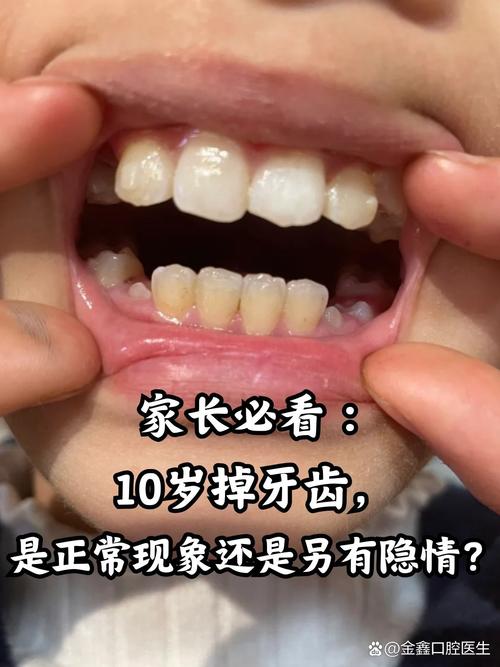 十岁女孩处于生长发育期，种植牙是否可行？需满足哪些条件？会不会影响颌骨正常发育？-图2