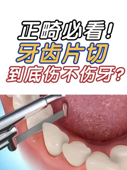 侧切牙有蛀牙/龋坏还能做正畸吗?烂牙未治好会影响矫正效果或导致牙齿健康问题吗?-图1 侧切牙有蛀牙/龋坏还能做正畸吗?烂牙未治好会影响矫正效果或导致牙齿健康问题吗?-图1