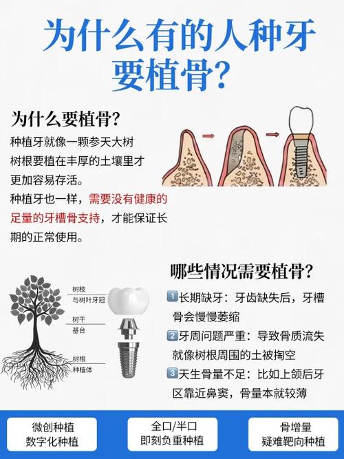 骨量不足也能种牙？不需要植骨的种牙技术真的靠谱吗？适合哪些人群？-图2