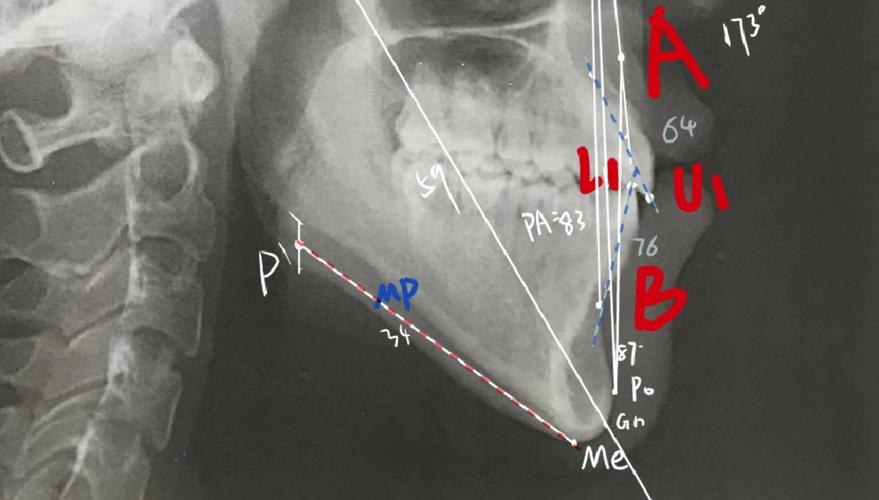 正畸头影测量软件安装时，不同操作系统（Windows/macOS）的具体步骤是什么？安装后如何校准才能保证测量数据准确？-图1