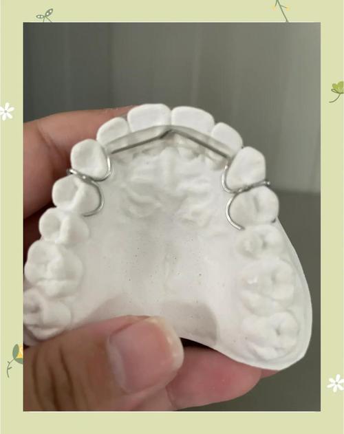 华西口腔正畸隐形矫正-图2