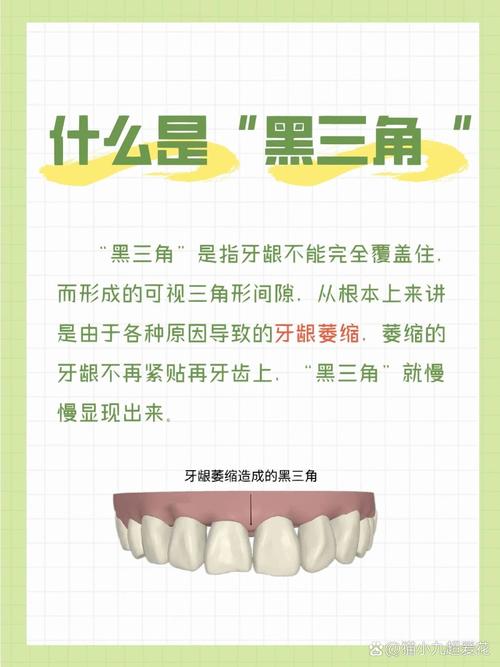 牙齿黑三角是怎么形成的？会对牙齿健康和美观造成哪些影响？有哪些科学有效的解决方法？-图3