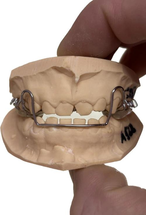 正畸推簧制作的具体步骤是怎样的？不同病例下制作方法有何差异，需注意哪些关键细节？-图1