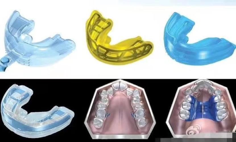 MRC肌功能矫正正畸与传统正畸有何本质区别？它如何通过肌肉训练实现牙齿与颌面的协同矫正？-图2