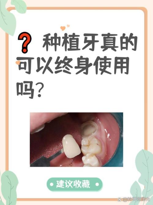 种牙被列为三级手术，这一高风险分类对患者意味着什么？需警惕哪些潜在风险又该如何选择合格机构？-图2