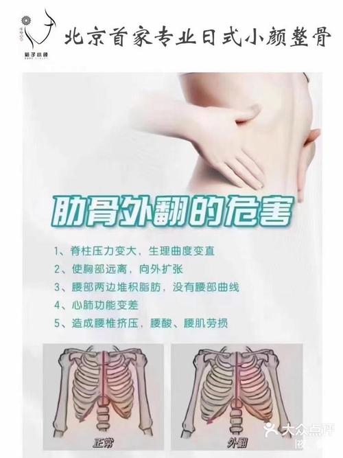 肋骨外翻矫正方法有哪些?不同矫正方式的效果、适用人群及注意事项详解-图3 肋骨外翻矫正方法有哪些?不同矫正方式的效果、适用人群及注意事项详解-图3