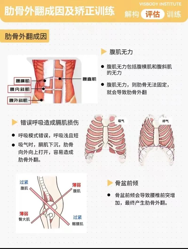 肋骨外翻矫正方法有哪些？不同矫正方式的效果、适用人群及注意事项详解-图2