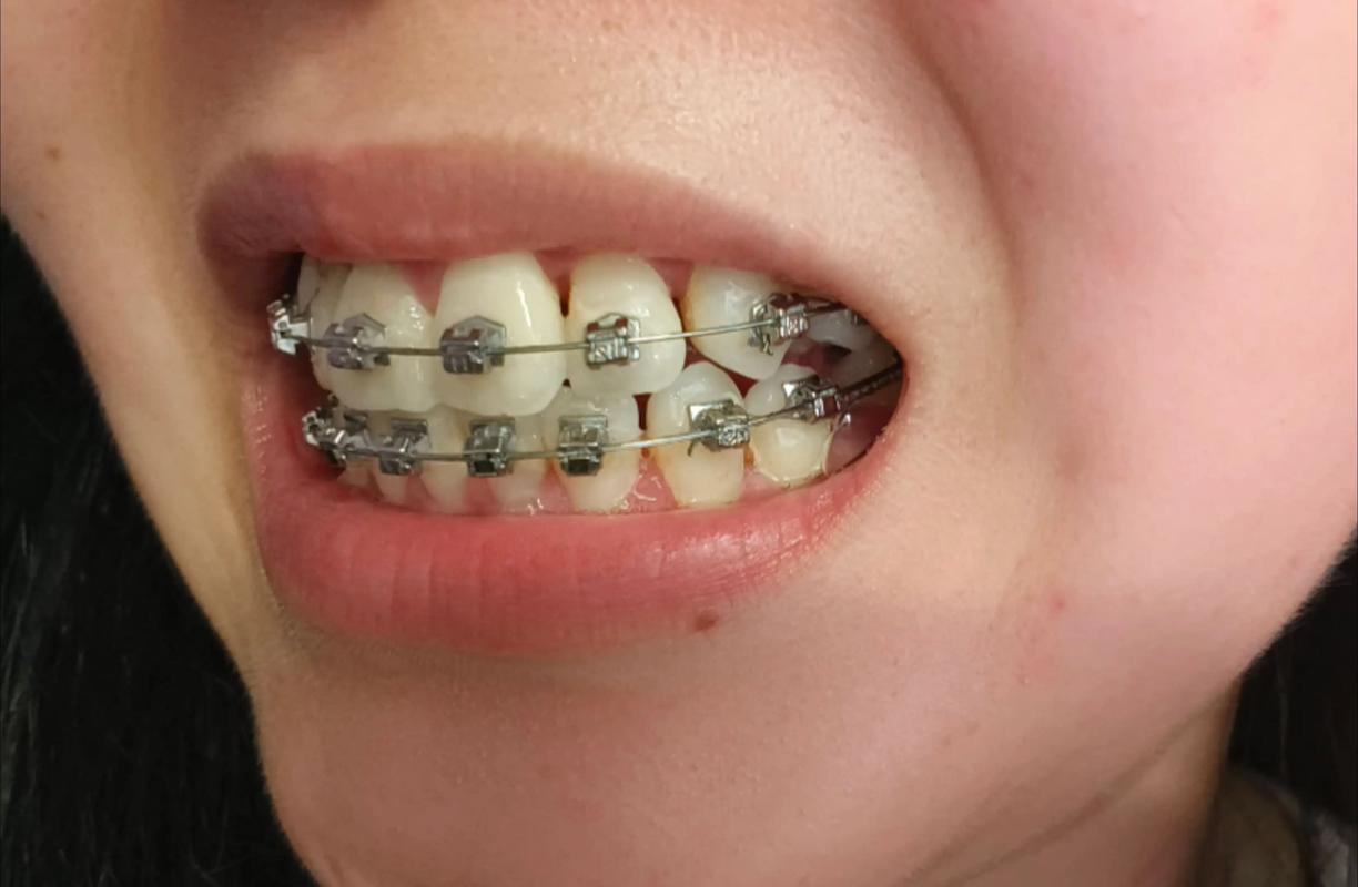 2025年零基础想学正畸，从入门到实操需要多久？关键知识点、学习路径和行业新趋势全解析？-图2