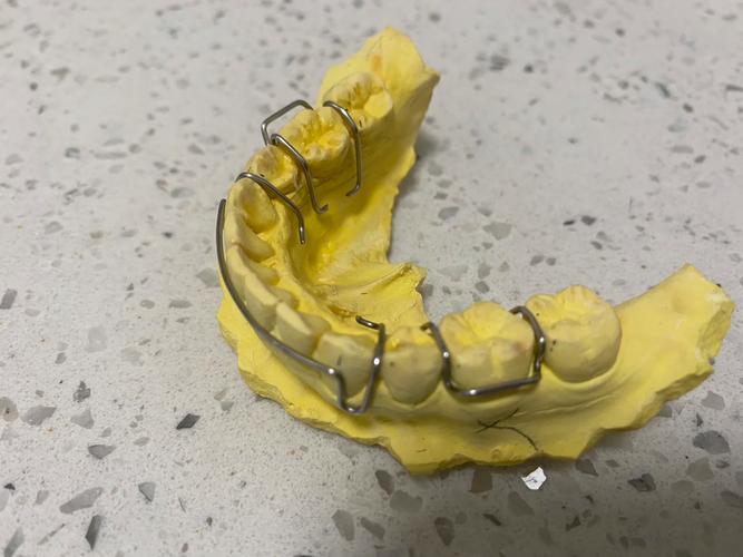 双曲唇弓弯制过程中如何精准控制弧度与角度?临床常见弯制误区及解决方法有哪些?-图2 双曲唇弓弯制过程中如何精准控制弧度与角度?临床常见弯制误区及解决方法有哪些?-图2