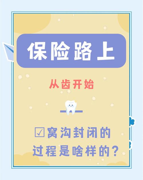 窝沟封闭操作方法的具体步骤是怎样的?操作中如何把握酸蚀时间与光照强度以确保封闭效果?-图2 窝沟封闭操作方法的具体步骤是怎样的?操作中如何把握酸蚀时间与光照强度以确保封闭效果?-图2