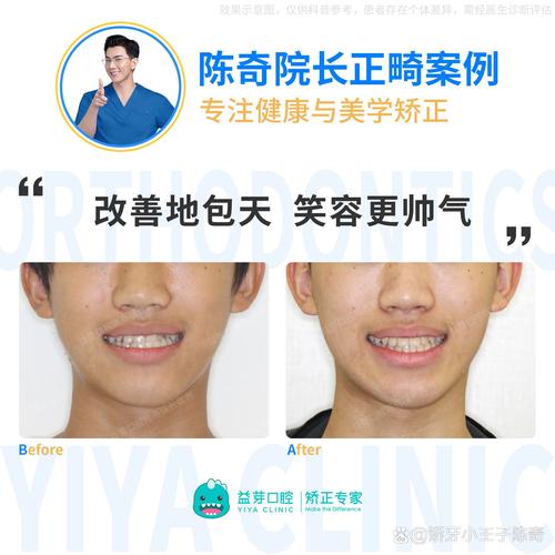 全国正畸牙齿医院怎么选？哪些才算真正的好？资质、口碑、技术到底哪个更重要？-图3